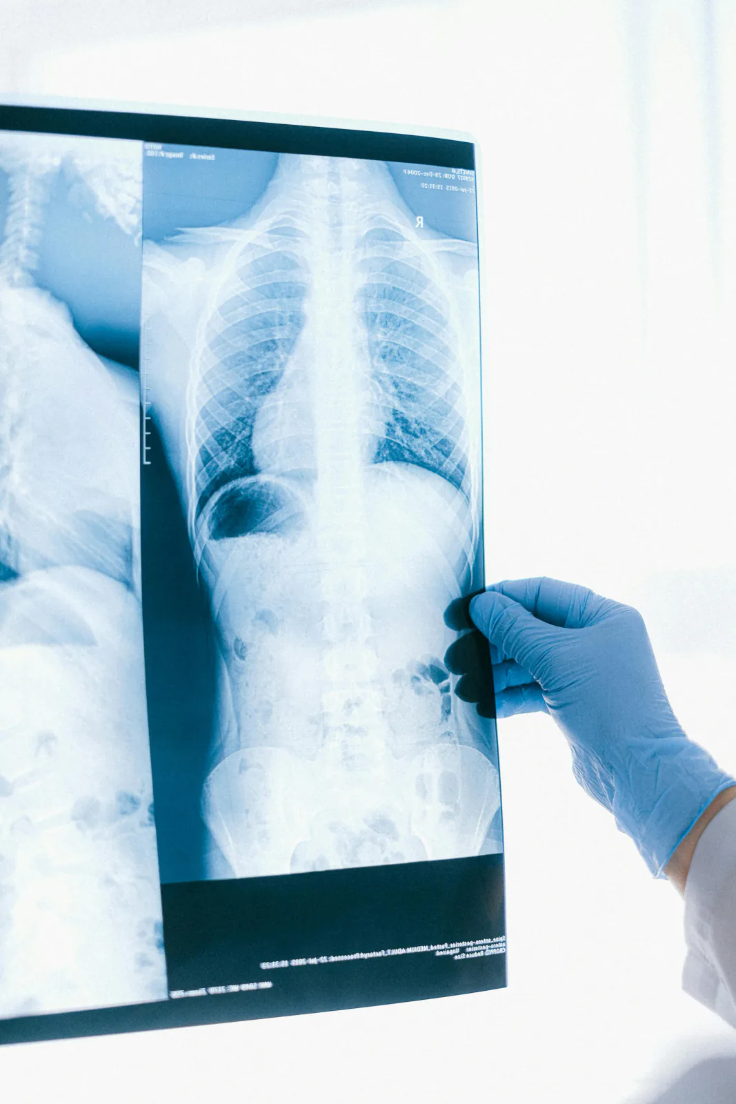 Equipo de imagenología para estudios de rayos X